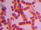 Розробки уроків до теми “Бактерії” для 7 кл.